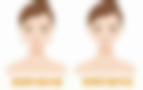 三、常见治疗方案对比