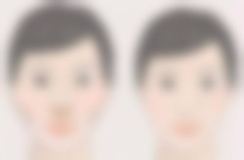 四、适合做筋膜恒久无痕双眼皮的人群