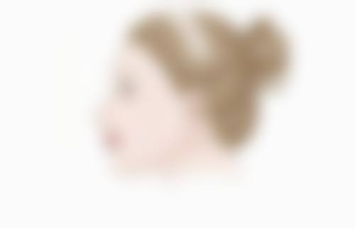 一、蒸汽眼罩能消除眼袋吗之眼袋的类型