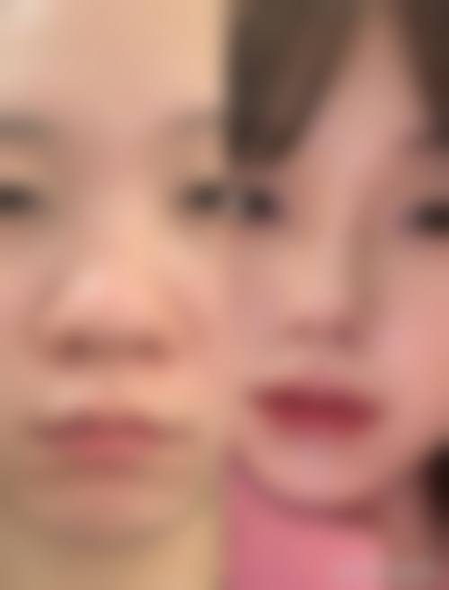 二、首都医 科 大学附属北京友谊医院(医学美容中 心)怎么样?