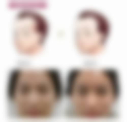 九、无锡新未来整形医疗美容门诊部真实的患者评价