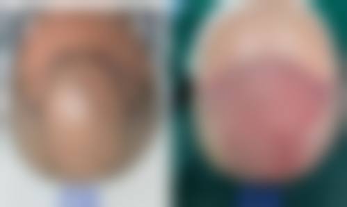 六、广州番禺碧莲盛整形医疗美容诊所地址及交通