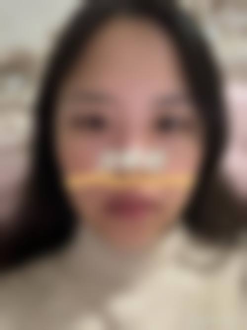 九、解放军第100医院整形美容外科真实的患者评价