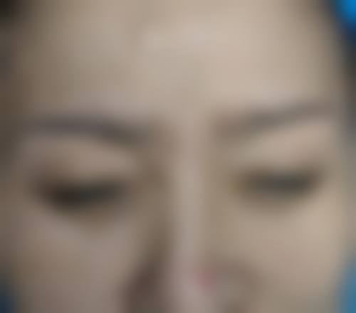 二、解放军第100医院整形美容外科怎么样？