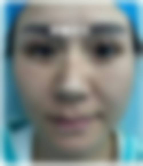 四、解放军第100医院整形美容外科特色项目