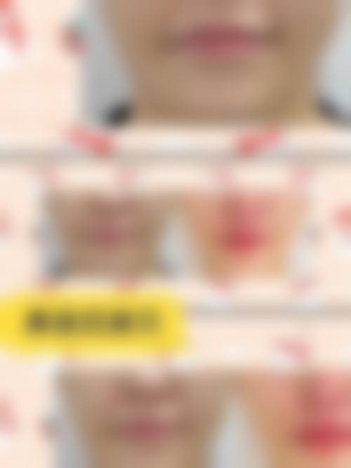 六、邯郸欣之颜整形医院价格表