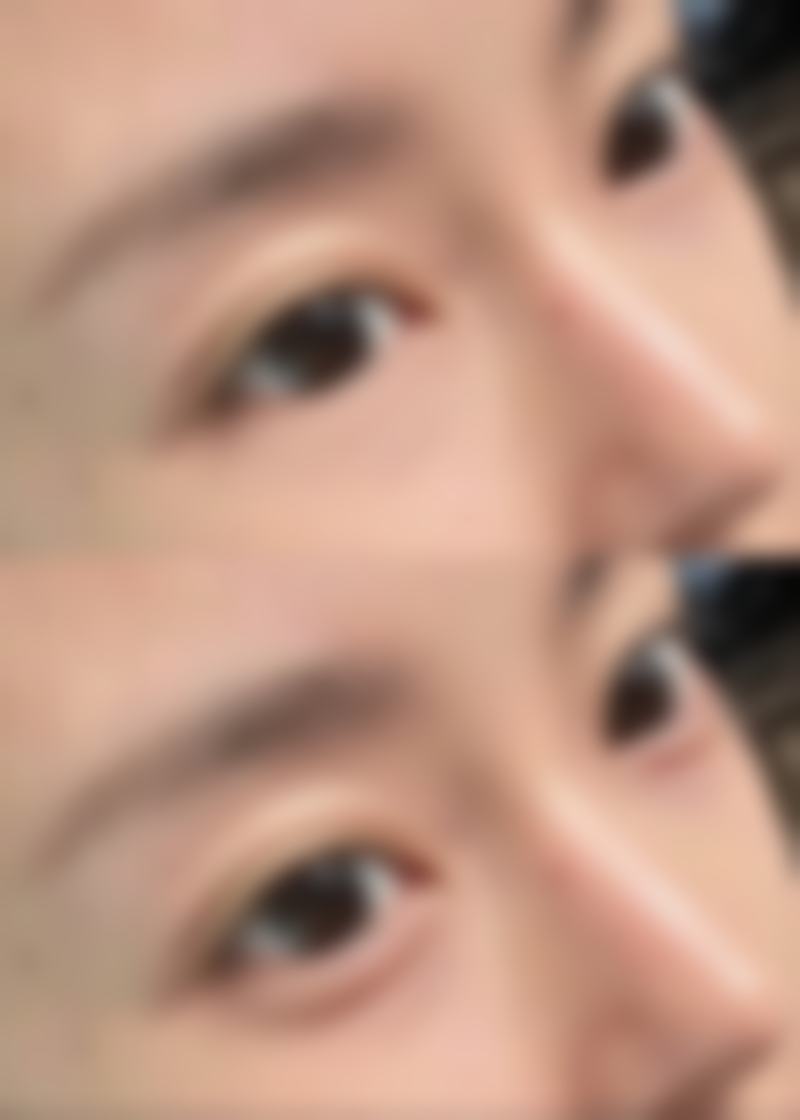 八、秦皇岛花之吻医疗美容诊所预约方式