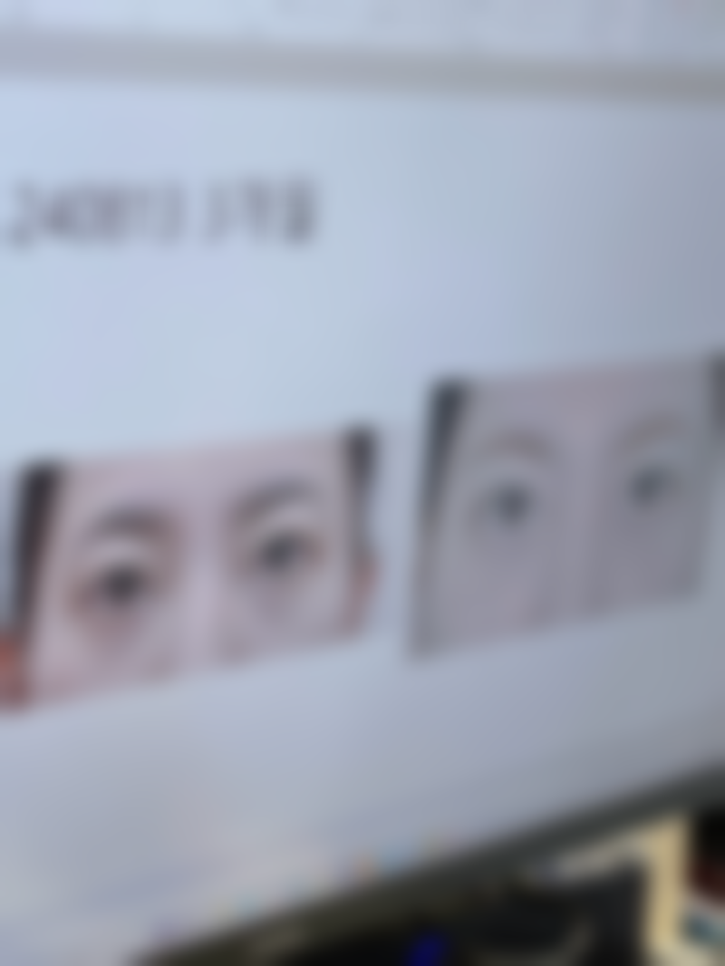 一、手术疤痕修复的关键思路及阶段