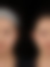 六、韩国 EVE 整形医院预约方式