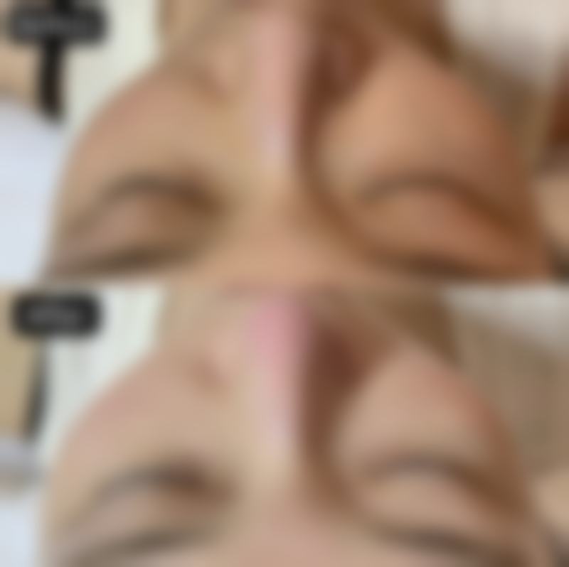 蒸汽眼罩能消除眼袋吗？了解适用类型与护理方法，助你改善眼部困扰 