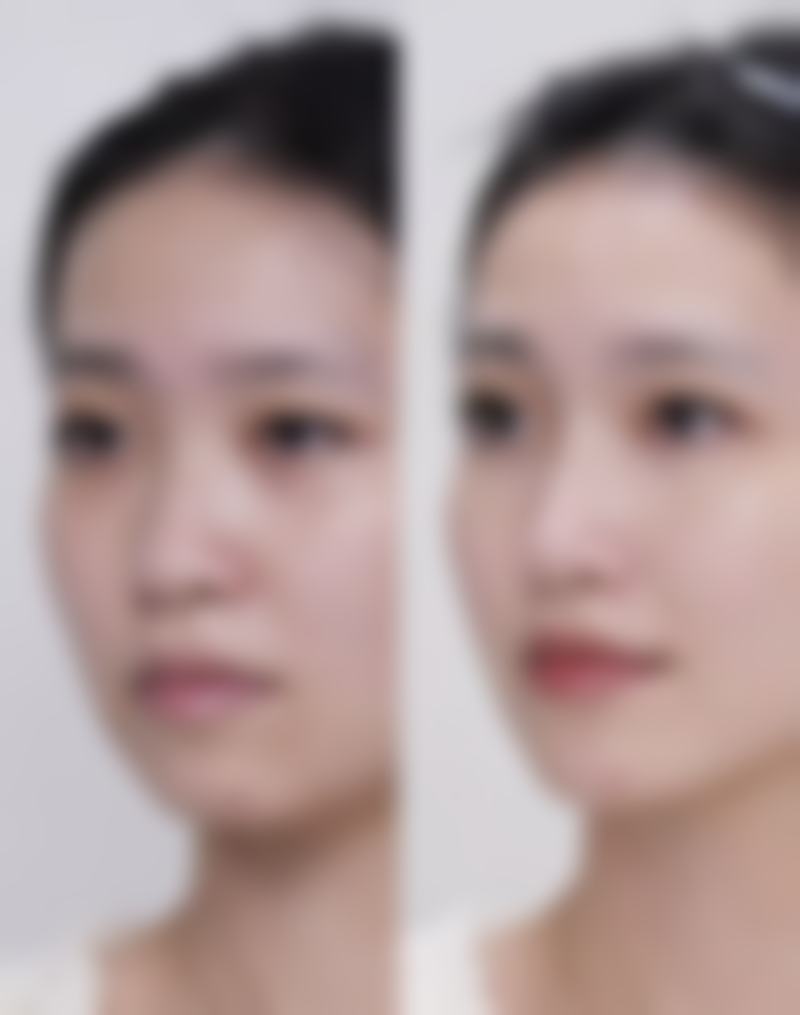 二、杭州临安谢金芳整形医院怎么样?