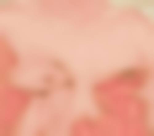 四、修复疤痕疙瘩的注意事项