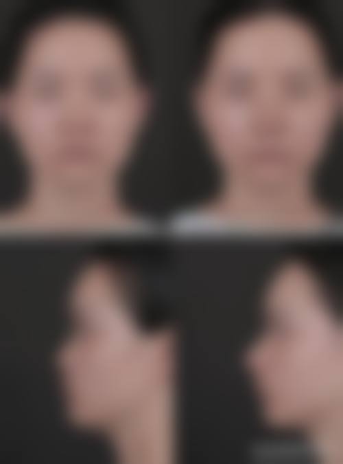 七、上海市复旦大学附属中山医院整形外科预约方式