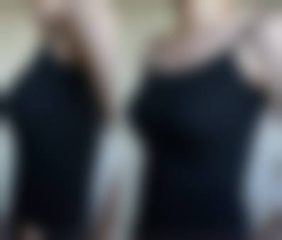 八、上海市复旦大学附属中山医院整形外科真实的患者评价