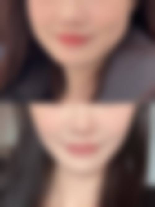 二、内蒙古林业总医院烧伤整形科怎么样?