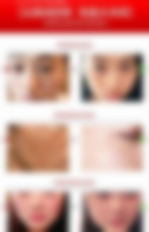 四、南昌发森林植发医院特色项目