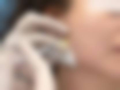 六、宁德华美整形医院价格表