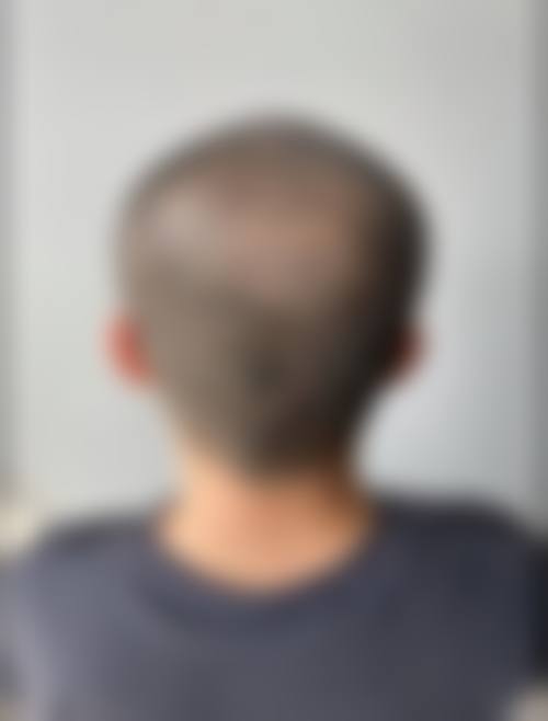 四、宁波谛蕊医疗美容诊所特色项目