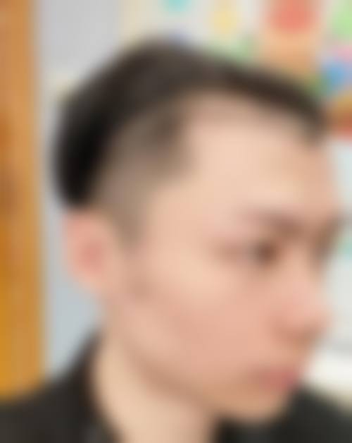 八、漳州雍禾植发医院真实的患者评价