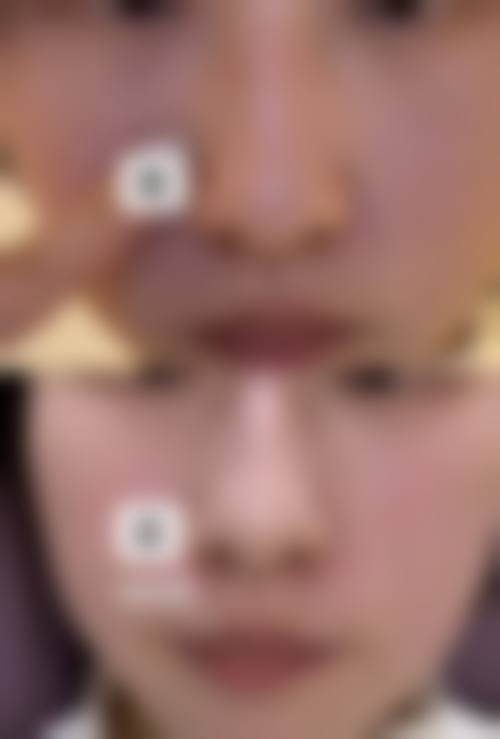 三、简阳直客医疗美容门诊诊疗项目有哪些？