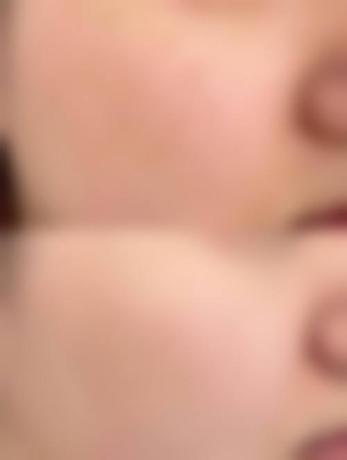 八、义乌恒美医疗美容诊所真实的患者评价