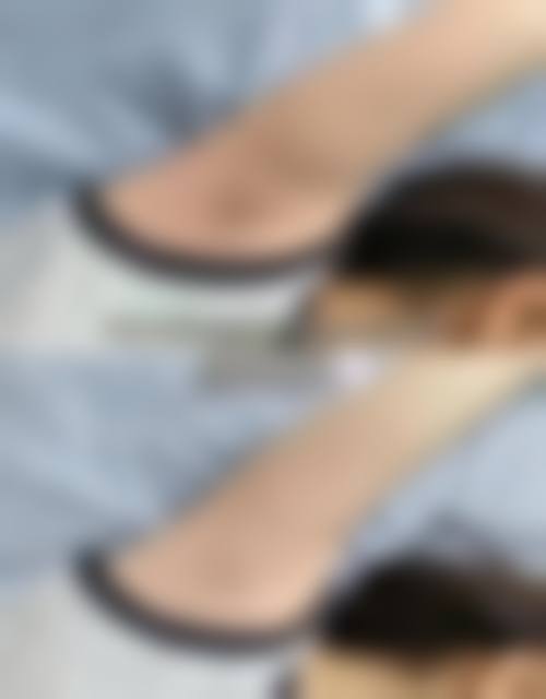 九、潮州保丽圣美医疗美容门诊部真实的患者评价