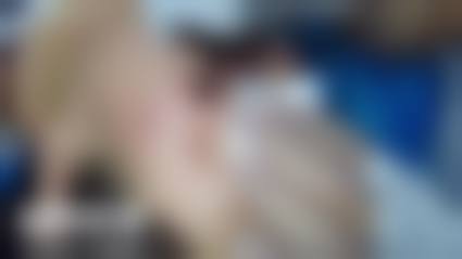 三、内蒙古林业总医院烧伤整形科诊疗项目有哪些?