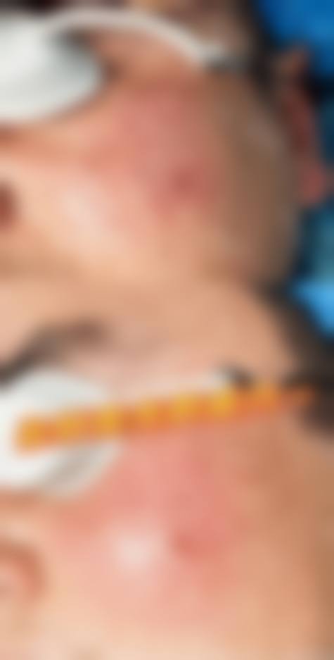 六、内蒙古林业总医院烧伤整形科价格表