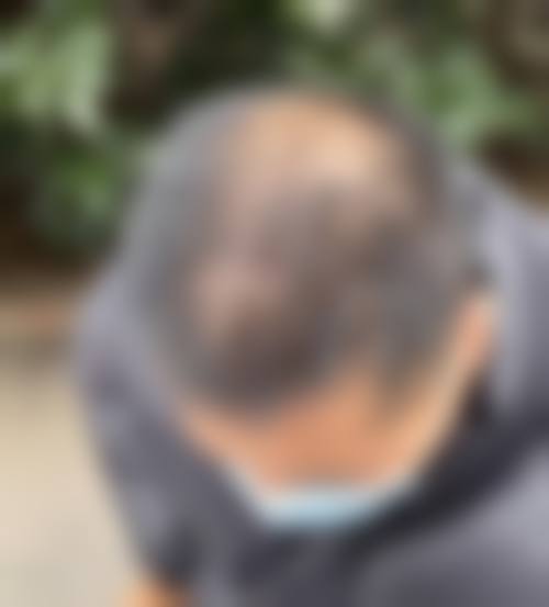 九、美丽薇医疗美容诊所真实的患者评价