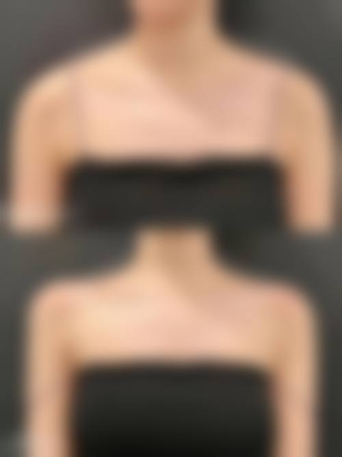 八、驻马店雅坤卫红医疗美容诊所真实的患者评价