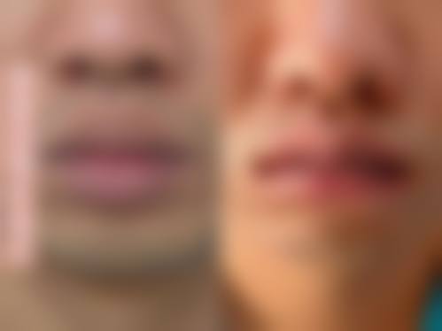 七、襄阳美度非凡医疗美容门诊部预约方式