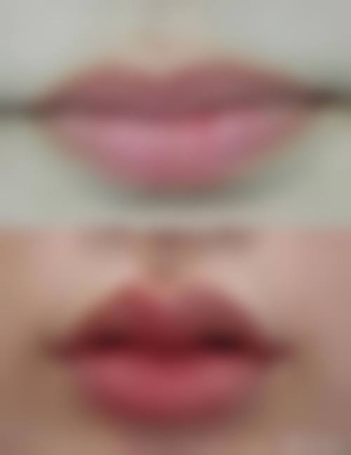 二、简阳直客医疗美容门诊怎么样？