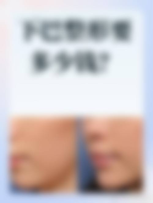 二、驻马店雅坤卫红医疗美容诊所怎么样？