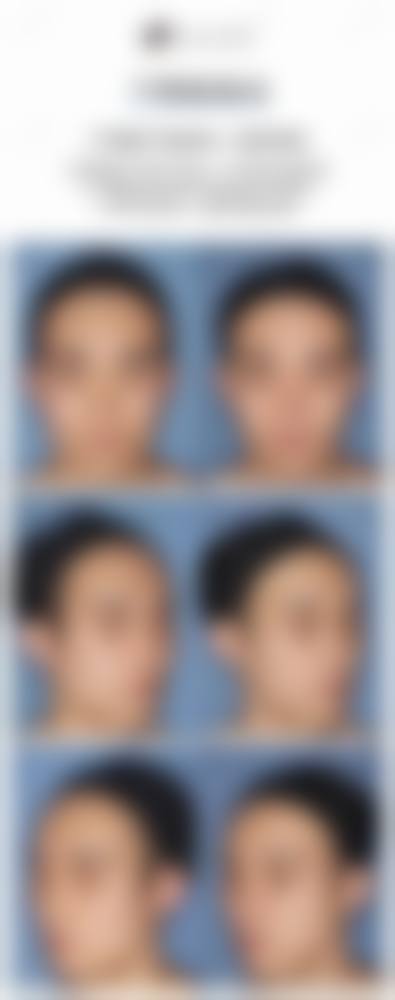 五、驻马店雅坤卫红医疗美容诊所价格表