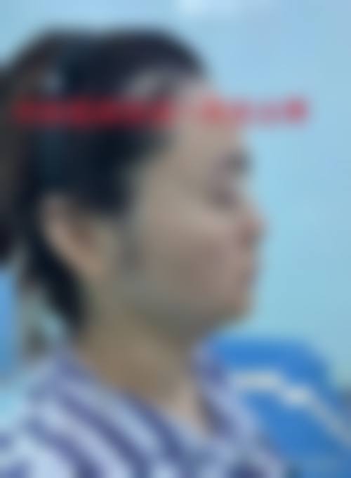 六、潮州保丽圣美医疗美容门诊部价格表