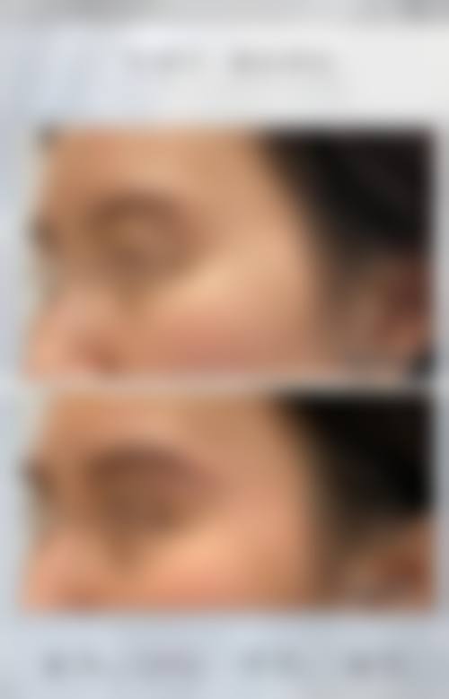 四、天津觅龄空间整形医院特色项目