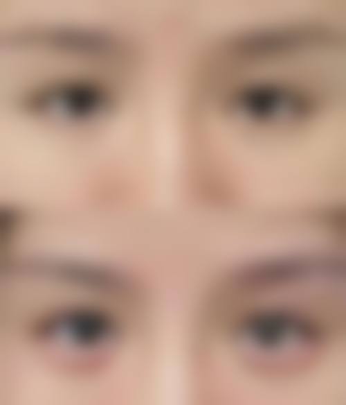 二、惠州伊生美整形医院怎么样？