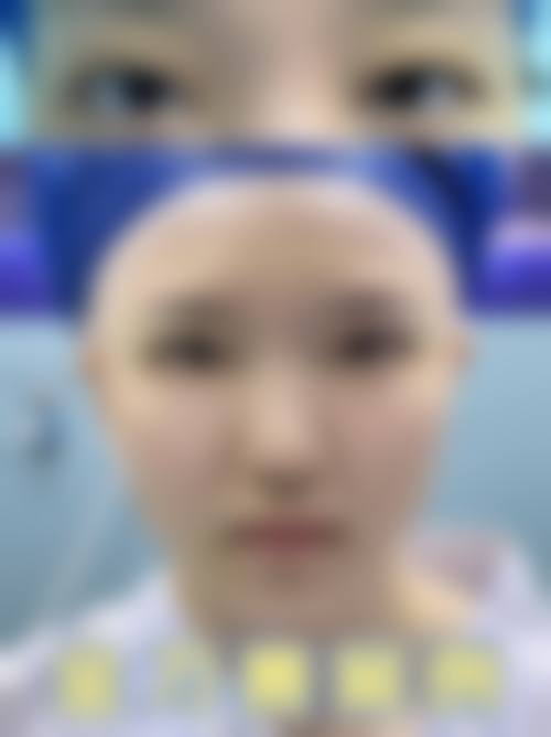 九、温岭善美医疗美容门诊部真实的患者评价