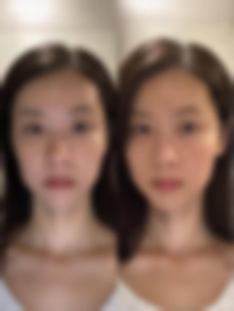 一、宁德华美整形医院正规吗？