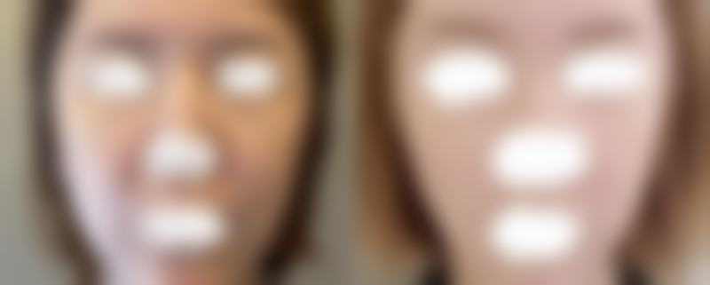 八、西安现代妇产整形医疗美容科真实的患者评价