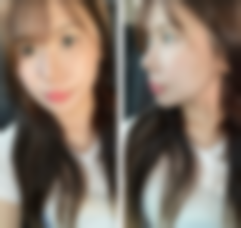 九、宁德华美整形医院真实的患者评价