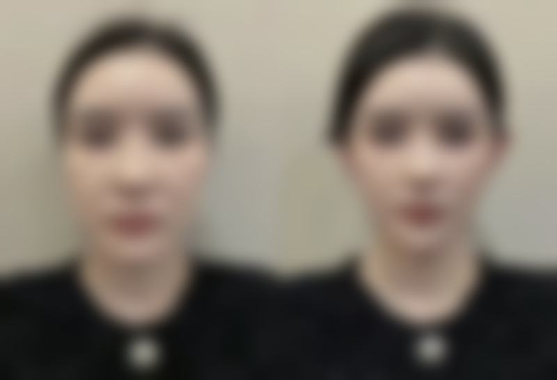 五、其他有效改善眼袋的日常方法