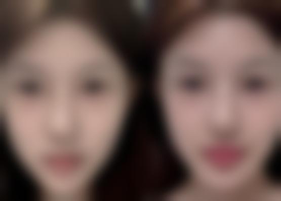 五、胳膊上增生疤痕的药物治疗选择