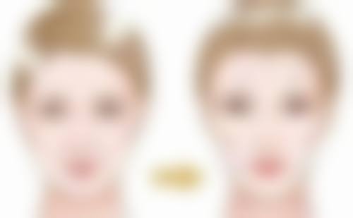 五、做了光子嫩肤可以打瘦脸针吗?瘦脸针的个性化方案