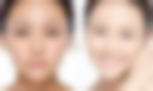 一、腰腹吸脂还会反弹吗：先了解吸脂原理