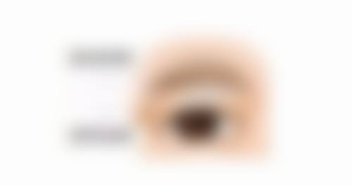 二、影响小腹抽脂修复的因素