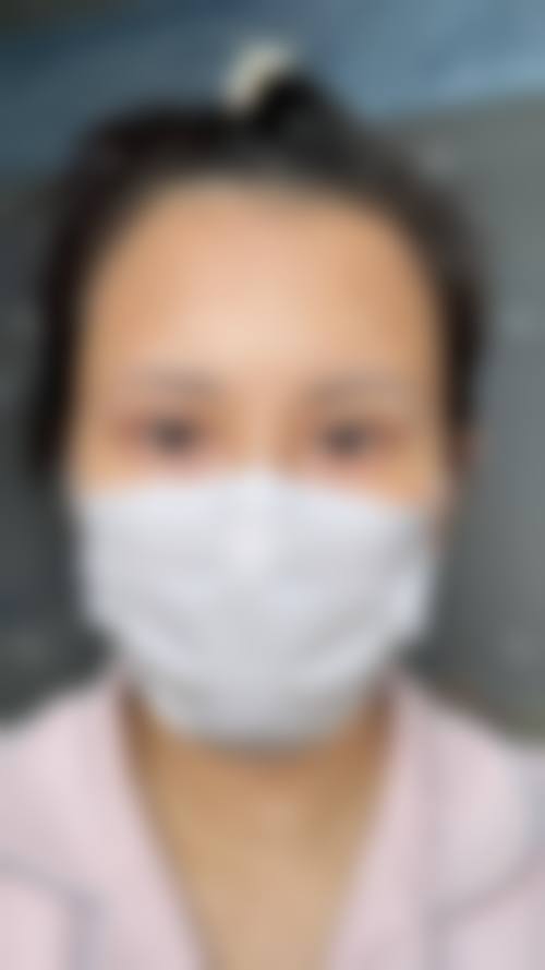 八、北京美尔目定慧医院医疗美容整形外科真实的患者评价