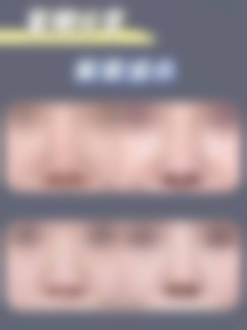 八、楚雄吴氏嘉美医疗美容真实的患者评价