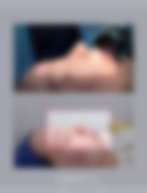 四、青岛美宏乐医疗美容门诊部特色项目