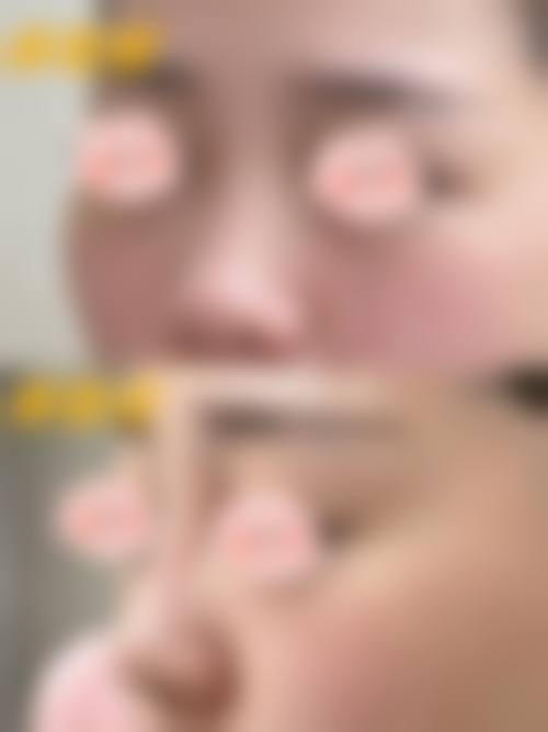 四、Brand New皮肤科特色项目